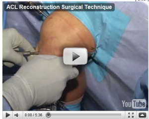 biologic-knee-replacement